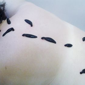medicininės dėlės